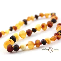 Healing Amber Baltic Amber Teething Bracelets - 5.5 inches