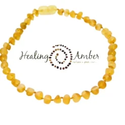 Healing Amber Raw Baltic Amber Teething Necklace - 11 inch