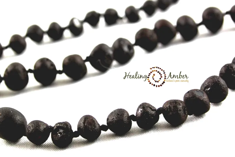 Healing Amber Raw Baltic Amber Teething Necklace - 11 inch